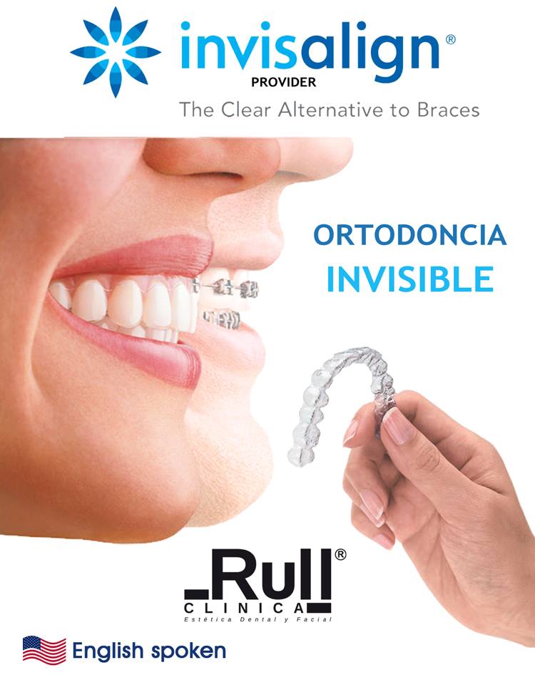 ortodoncia-invisible-invisalign
